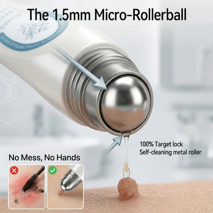 Official Store🎉7-𝐷𝑎𝑦 𝗧𝐚𝐠 & 𝗦𝗽𝐨𝐭 𝐄𝐫𝒂𝒔𝒆𝒓(Zero Pain, Zero 𝐒𝐜𝐚𝒓𝒔 Rollerball)